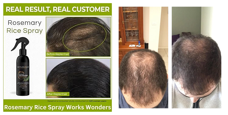 Rosemary Rice Water Hair Growth Spray Total 300 ml (Pack of 3) – Strengthens Roots, Reduces Hair Fall & Boosts Shine